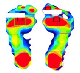 ForceMapping-Foot 足底压力分布测试系统